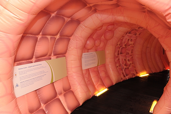 20 Meter langes Darmmodell