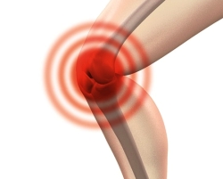Arthrose